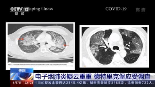 點擊進(jìn)入下一頁