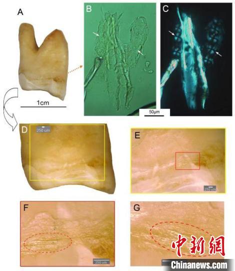 湖南道縣福巖洞8-12萬年前古人類剔牙行為的遺存痕跡?！清?供圖